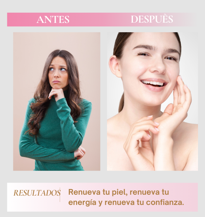 KIT RENOVACIÒN TOTAL